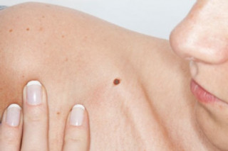 Lý giải nốt ruồi ở những vị trí ‘nhạy cảm’ trên cơ thể phụ nữ