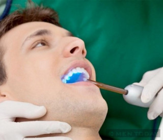Những hiểu lầm quanh việc chăm sóc răng miệng