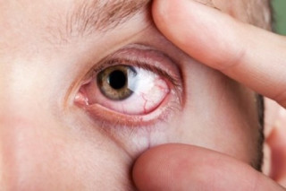 8 tình trạng của mắt cảnh báo bạn đang mắc bệnh hiểm nghèo