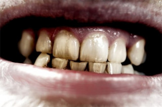 Hiểu 1001 sự thật về răng miệng sẽ giúp bạn tỏa sáng như “nữ thần”