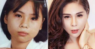 Cô gái Hà Nội: 9 năm thẩm mỹ 12 lần
