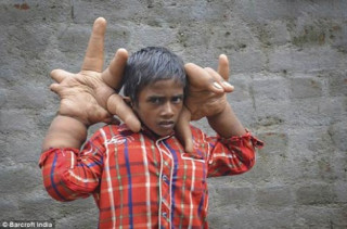 Kinh ngạc: Bé 8 tuổi có bàn tay lớn hơn đầu người
