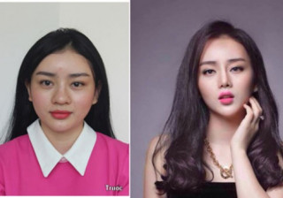 Mũi tẹt, bất lợi đủ đường?
