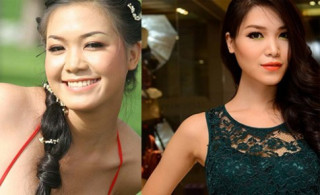 Sao Việt phân trần nghi vấn ‘dao kéo’