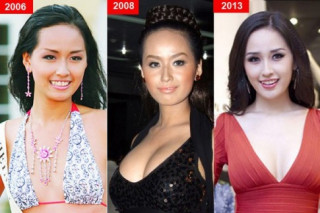 Sao Việt trước và sau ‘nghi án’ nâng ngực