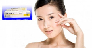 Trị mụn hiệu quả chỉ với…3000 đồng