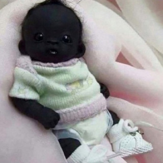 Bức ảnh “em bé Nam Phi đen nhất thế giới” gây tranh cãi