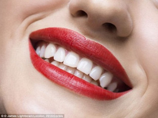 Chuyên gia mách bạn 10 cách làm trắng răng nhanh, rẻ