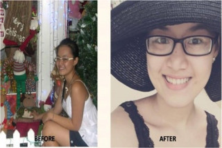 Cô gái Việt tắm trắng hiệu quả tại nhà chỉ trong 3 tuần