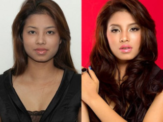 Dư luận quốc tế khơi lại nghi vấn Phạm Hương “dao kéo”