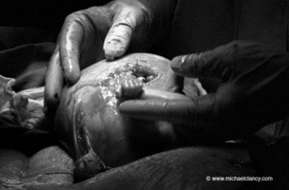 Gặp lại thai nhi trong bức ảnh nắm ngón tay bác sỹ chấn động thế giới
