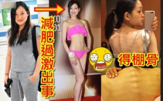 Thí sinh Hoa hậu Hong Kong nhịn ăn, gầy như bộ xương