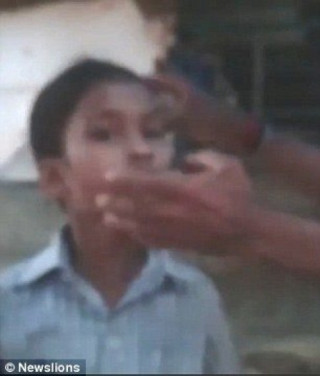 Sốc: Kiến làm tổ trong mắt bé gái Ấn Độ