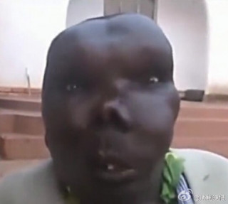 Người đàn ông xấu xí nhất Uganda đã làm cha lần thứ 8