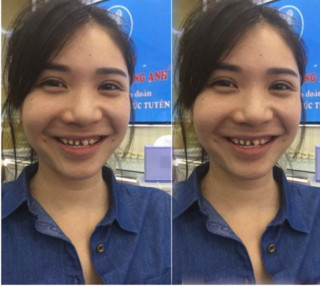 Thanh Bi và dàn sao Việt đẹp bất ngờ nhờ trùng tu bộ phận này!