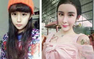 8 màn dao kéo khiến mọi người “lạnh sống lưng“