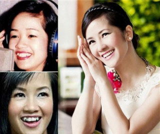 Bất ngờ trước hàm răng thật xấu xí của sao Việt