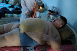 Hình ảnh cậu bé 11 tuổi đau đớn điều trị béo phì khiến người lớn “rùng mình”