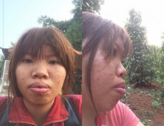 Cô gái Đăk Nông từng khốn khổ vì bị chê xấu nay đã lột xác ngoạn mục sau 1 tháng