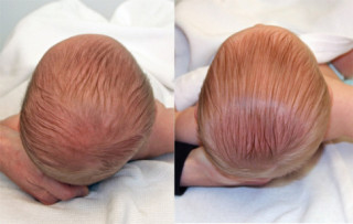 4 tật xấu khi ngủ khiến trẻ sơ sinh dễ méo đầu, vẹo cổ mà chưa mẹ nào biết