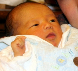 Bệnh vàng da ở trẻ sơ sinh: Cho con bú đầy đủ giúp giảm tình trạng bệnh