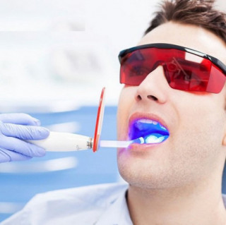 Tẩy trắng răng – Những điều cần biết để tránh tiền mất tật mang
