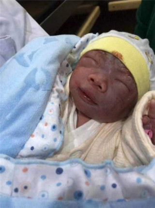 Bé sơ sinh chào đời bị gia đình chối bỏ vì quá xấu, 1 tháng sau lột xác nhận không ra