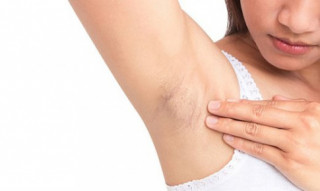 Chăm sóc vùng da dưới cánh tay thế nào để tạm biệt thâm sạm: Nàng nắm rõ bao nhiêu?