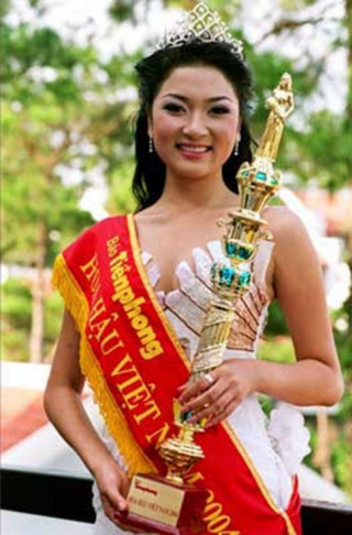 Lần đầu tiên, Hoa hậu Nguyễn Thị Huyền lên tiếng về tin đồn phẫu thuật thẩm mỹ