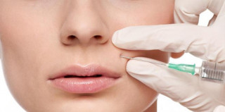 Làm đẹp bằng phương pháp tiêm filler: Cẩn thận “tiền mất, tật mang” khi ham giá rẻ