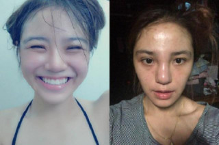 Chi 100 triệu để trùng tu nhan sắc, cô gái khóc ròng khi nhận kết quả khủng khiếp