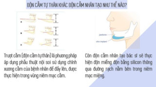Hết gọt đến độn bằng silicon, giờ đây chị em tìm đến phương pháp “trượt” với chính cằm của mình!
