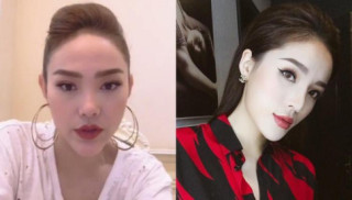 Không chỉ thích cằm nhọn Vline, những sao nữ Vbiz còn thích thẩm mỹ bộ phận này trên cơ thể
