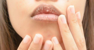 Môi khô nứt nẻ ngày đông nhờ có 5 cách trị này mà mềm mại, căng mọng sau 1 đêm
