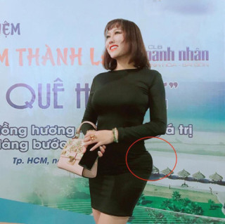 Phi Thanh Vân lộ vòng 3 méo mó sau một năm trải qua ca đại phẫu thuật “lột xác”!