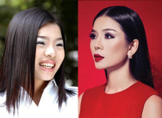 Tháo sụn mũi đã là gì, đây mới là bước “lên đời” nhan sắc sáng suốt nhất của Lệ Quyên