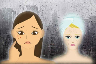 Thời tiết mát mẻ, đừng tưởng mụn sẽ không bùng nổ, lầm to đấy!