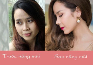 Xuất hiện với diện mạo khác lạ, phải chăng Lưu Hương Giang chạy theo trào lưu độn trán?