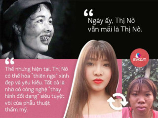 Khi “dao kéo” đổ bộ, ai cũng có thể hoá mỹ nhân, nhưng sau tất cả, có chắc bình yên?