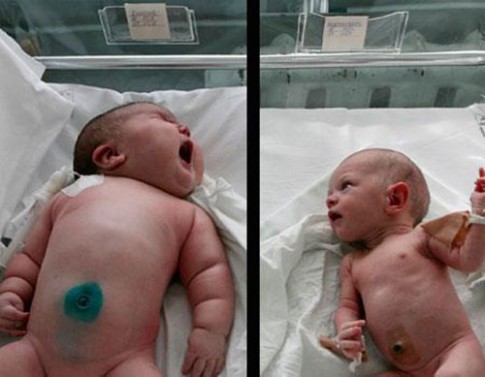8 bé sơ sinh vừa chào đời đã...to nhất thế giới