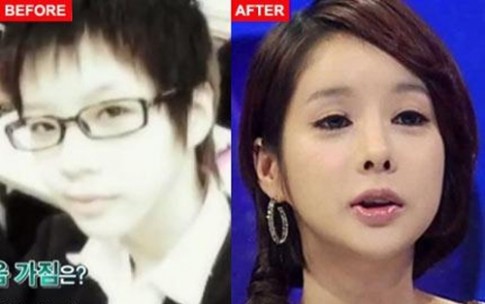 Cô gái Hàn đẹp sau 120 lần phẫu thuật