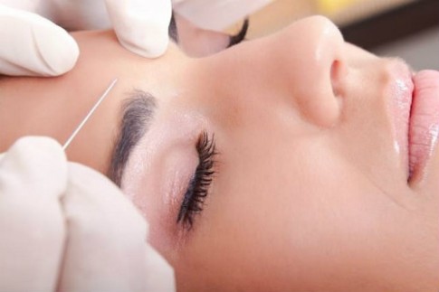 Những lý do để nói không với botox