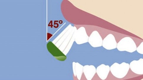 Phải làm sao khi đánh răng nhiều mà miệng vẫn hôi, lợi vẫn viêm?