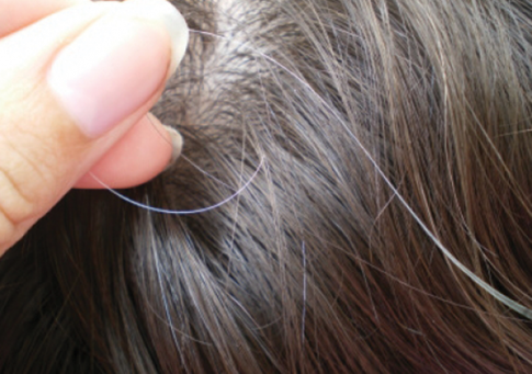 Cách chăm sóc và điều trị tóc bạc sớm bằng củ gừng