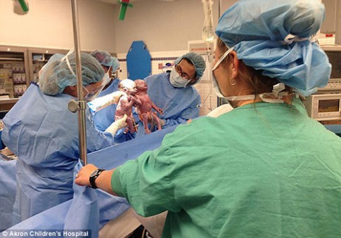 Cặp song sinh nắm tay nhau ra khỏi tử cung mẹ: sau 2 năm chưa thể tách rời