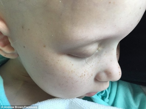 Điều kỳ diệu xảy ra với bé gái ung thư trong bức ảnh “sợi lông mi cuối cùng” nổi tiếng