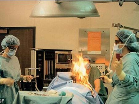 Bác sĩ đốt bệnh nhân trên bàn phẫu thuật